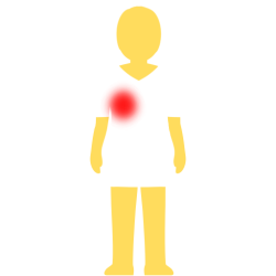 A person with no hair or face, an emoji yellow skintown, and a white pair of shorts and pants with no visible divider between the two. there's a glowing red spot on their left chest.
